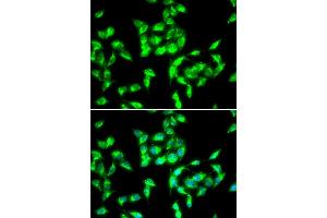 Immunofluorescence analysis of HeLa cell using ANTXR1 antibody. (ANTXR1 抗体)