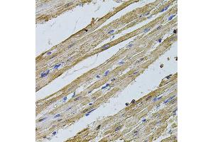 Immunohistochemistry of paraffin-embedded rat heart using CSNK2B antibody (ABIN1872042) at dilution of 1:100 (40x lens). (CSNK2B 抗体)