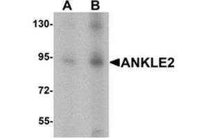 Western blot analysis of ANKLE2 in SW480 cell lysate with ANKLE2 antibody at (A) 1 and (B) 2 ug/mL. (ANKLE2 抗体  (Middle Region))