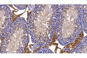 Detection of H-FABP in Rat Lung Tissue using Polyclonal Antibody to Heart-type Fatty Acid Binding Protein (H-FABP)