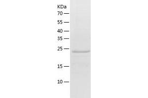 Western Blotting (WB) image for Kallikrein 14 (KLK14) (AA 24-250) protein (His tag) (ABIN7123660)