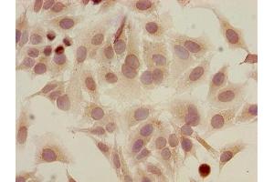 Immunocytochemistry analysis of Hela cells using ABIN7139183 at dilution of 1:100 (HIST1H2AG 抗体  (acLys5))