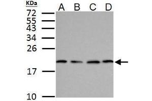 Western Blotting (WB) image for anti-Superoxide Dismutase 1, Soluble (SOD1) (C-Term) antibody (ABIN2854826)
