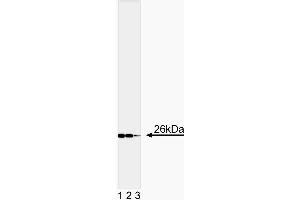 Western blot analysis of Bcl-2 (Second Panel). (Bcl-2 抗体  (AA 41-54))
