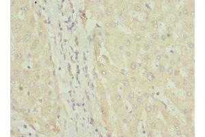 Immunohistochemistry of paraffin-embedded human liver tissue using ABIN7152580 at dilution of 1:100 (FASTK 抗体  (AA 360-549))
