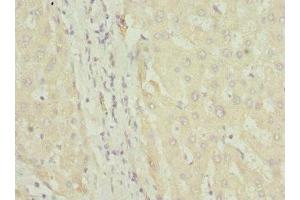 Immunohistochemistry of paraffin-embedded human liver tissue using ABIN7152580 at dilution of 1:100