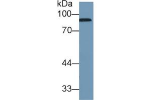 Western Blot; Sample: Human Serum; Primary Ab: 1µg/ml Rabbit Anti-Human CFB Antibody Second Ab: 0. (Complement Factor B 抗体  (AA 477-600))