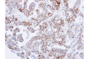 Immunohistochemistry (IHC) image for anti-Syntrophin, beta 2 (Dystrophin-Associated Protein A1, 59kDa, Basic Component 2) (SNTB2) antibody (ABIN2856646)