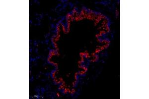 Immunofluorescence analysis of paraffin embedded mouse lung using Flt4 (ABIN7076194) at dilution of 1: 400 (Vegf Receptor 3 抗体)