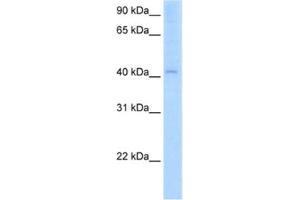 Western Blotting (WB) image for anti-Arylacetamide Deacetylase (Esterase) (AADAC) antibody (ABIN2462826) (AADAC 抗体)