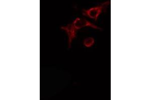 ABIN6274490 staining Hela cells by IF/ICC. (ADPGK 抗体  (Internal Region))