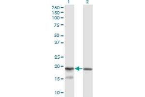 Western Blot analysis of KLRC4 expression in transfected 293T cell line by KLRC4 monoclonal antibody (M03), clone 1D10.