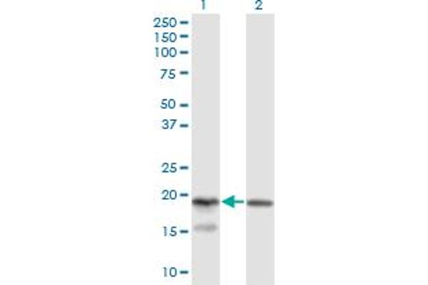 KLRC4 Antikörper  (AA 1-158)