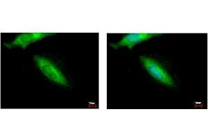 ICC/IF Image HIP55 antibody [N1], N-term detects DBNL protein at cytoplasm by immunofluorescent analysis. (DBNL 抗体  (N-Term))