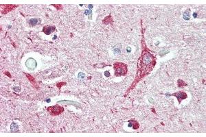 Detection of DDR2 in Human Cerebrum Tissue using Polyclonal Antibody to Discoidin Domain Containing Receptor 2 (DDR2) (DDR2 抗体  (AA 578-817))