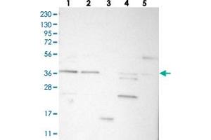 Retinoic Acid Induced 12 (RAI12) anticorps