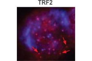 TRF2 Immunofluorescence. (TBPL1 抗体)