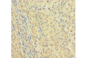 Immunohistochemistry (IHC) image for anti-Immunoglobulin Heavy Constant gamma 1 (G1m Marker) (IGHG1) (AA 1-330) antibody (ABIN7156085)