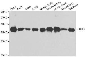 Western blot analysis of extracts of various cell lines, using LDHB antibody. (LDHB 抗体)