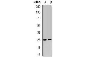Western blot analysis of IGFBP1 expression in HepG2 (A), MCF7 (B) whole cell lysates. (IGFBPI 抗体)