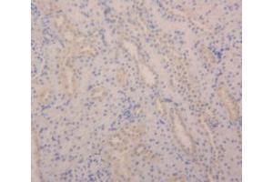 IHC-P analysis of Rat Kidney Tissue, with DAB staining. (Angiopoietin 2 抗体  (AA 33-243))
