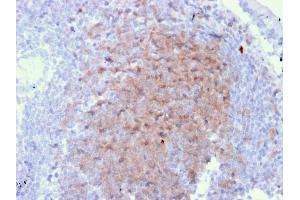 Formalin-fixed, paraffin-embedded human Lymph Node in Colon stained with CD72 Mouse Monoclonal Antibody (BU40). (CD72 抗体)
