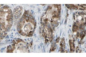 ABIN6277764 at 1/100 staining Human prostate tissue by IHC-P. (Golgin A2 (GOLGA2) (N-Term) 抗体)
