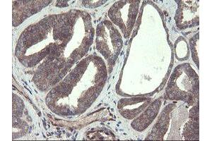 Image no. 3 for anti-TSC22 Domain Family, Member 1 (TSC22D1) antibody (ABIN1501540)