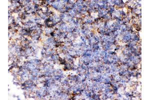 Immunohistochemistry (Paraffin-embedded Sections) (IHC (p)) image for anti-CD14 (CD14) (AA 65-327) antibody (ABIN3044565)