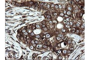 Image no. 3 for anti-Armadillo Repeat Containing 1 (ARMC1) antibody (ABIN1496724)