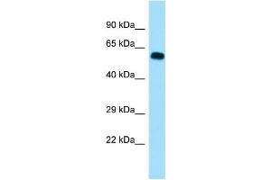 WB Suggested Anti-SGOL1 Antibody Titration: 1.