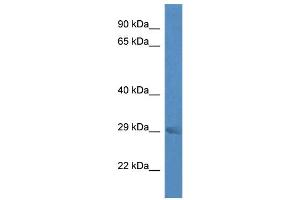 WB Suggested Anti-Rab23 Antibody Titration: 1. (RAB23 抗体  (Middle Region))