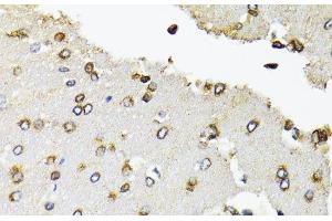 Immunohistochemistry of paraffin-embedded Rat brain using POLR2B Polyclonal Antibody at dilution of 1:100 (40x lens). (POLR2B 抗体)