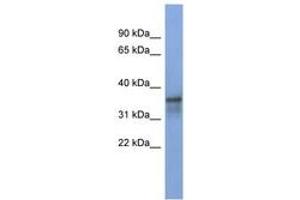 Image no. 1 for anti-RNA Binding Motif Protein 9 (RBM9) (AA 287-336) antibody (ABIN6743007) (RBM9 抗体  (AA 287-336))
