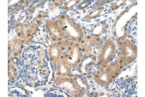 SLC39A6 antibody was used for immunohistochemistry at a concentration of 4-8 ug/ml to stain Epithelial cells of renal tubule (arrows) in Human Kidney.