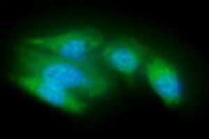 ICC/IF analysis of ACOT8 in A549 cells line, stained with DAPI (Blue) for nucleus staining and monoclonal anti-human ACOT8 antibody (1:100) with goat anti-mouse IgG-Alexa fluor 488 conjugate (Green). (ACOT8 抗体  (AA 1-319))