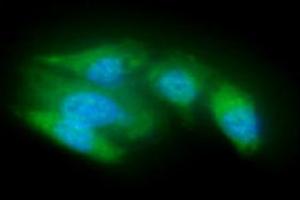 ICC/IF analysis of ACOT8 in A549 cells line, stained with DAPI (Blue) for nucleus staining and monoclonal anti-human ACOT8 antibody (1:100) with goat anti-mouse IgG-Alexa fluor 488 conjugate (Green). (ACOT8 抗体)