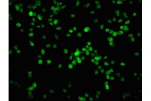 Immunofluorescence staining of K562 cells with ABIN7127740 at 1:100,counter-stained with DAPI. (Recombinant Retinoblastoma 1 抗体  (pSer780))