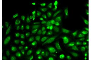 Immunofluorescence analysis of HeLa cells using SPHK1 antibody. (SPHK1 抗体)