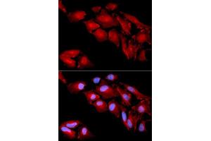 Immunofluorescence (IF) image for anti-Catenin (Cadherin-Associated Protein), delta 1 (CTNND1) (AA 573-832) antibody (ABIN3022309)