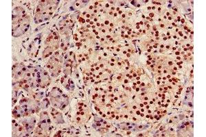 Immunohistochemistry of paraffin-embedded human pancreatic tissue using ABIN7142023 at dilution of 1:100 (AGPAT5 抗体  (AA 174-313))