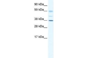 WB Suggested Anti-SOX17 Antibody Titration: 0. (SOX17 抗体  (C-Term))