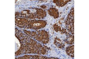 IHC analysis of SBP/SELENBP1 using anti-SBP/SELENBP1 antibody (ABIN7600755). (SELENBP1 抗体  (AA 23-462))