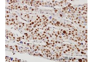 Image no. 4 for anti-serine/threonine Kinase 38 (STK38) (AA 1-466) antibody (ABIN599179) (STK38 抗体  (AA 1-466))