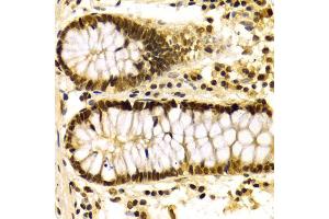 Immunohistochemistry of paraffin-embedded human colon using KPNA4 Antibody (ABIN5971058) at dilution of 1/100 (40x lens). (KPNA4 抗体)