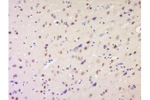 Formalin-fixed and paraffin embedded rat brain labeled with Anti-NSD1 Polyclonal Antibody, Unconjugated  at 1:200 followed by conjugation to the secondary antibody and DAB staining. (NSD1 抗体  (AA 2401-2600))