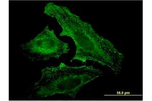 Immunofluorescence of monoclonal antibody to UVRAG on HeLa cell. (UVRAG 抗体  (AA 601-699))
