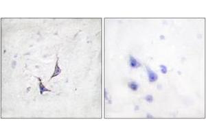 Immunohistochemistry analysis of paraffin-embedded human brain tissue, using Syndecan4 (Ab-179) Antibody. (SDC4 抗体  (AA 145-194))
