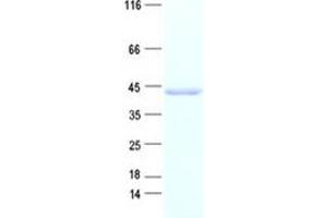 Western Blotting (WB) image for Cdk5 and Abl Enzyme Substrate 1 (CABLES1) protein (His tag) (ABIN2713000)