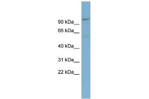 WB Suggested Anti-TBL3 Antibody Titration: 0. (TBL3 抗体  (N-Term))